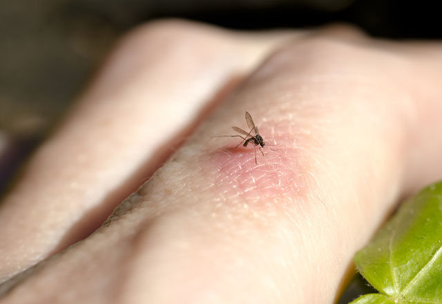 Sivrisineklerden kurtulmanın 9 bitkisel yolu