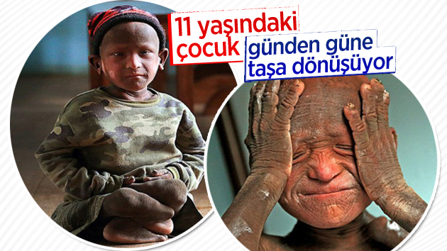 11 yaşındaki çocuk taşa dönüşüyor