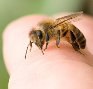 Arı sokmasına ne iyi gelir?