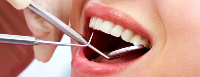 Diş taşı nasıl temizlenir?