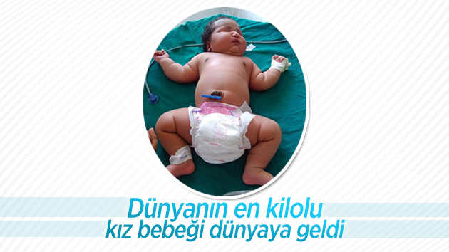 Dünyanın en kilolu kız bebeği doğdu