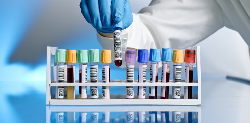 a hand of a doctor taking a blood sample tube