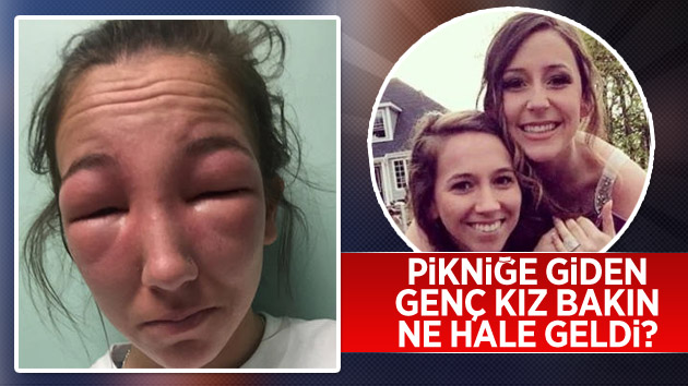 Pikniğe giden genç kız bakın ne hale geldi…